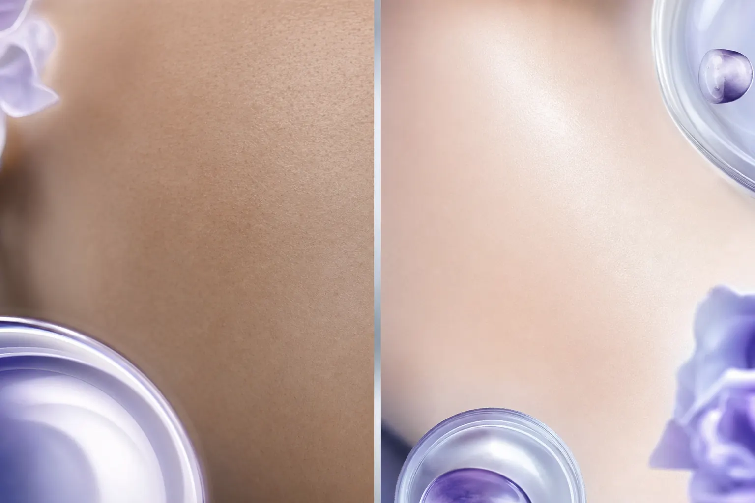 Mikrodermabrasion Vorher Nachher — Soforteffekt vs. Ergebnis nach kompletter Kur